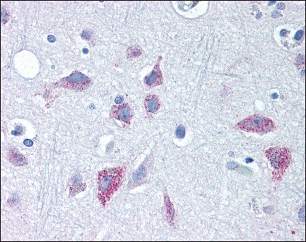 Anti-WNT8B antibody produced in rabbit