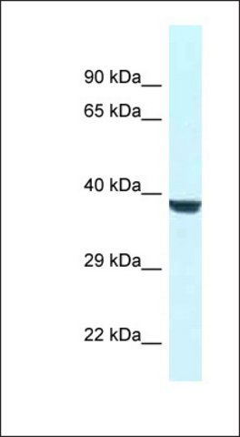 Anti-WDR45L antibody produced in rabbit