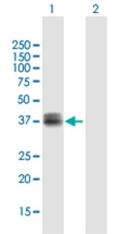 Anti-WISP3 antibody produced in mouse