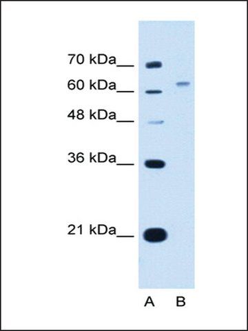 Anti-WSCD2 antibody produced in rabbit