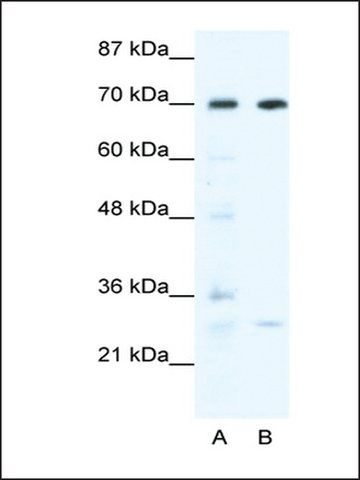 Anti-WRNIP1 antibody produced in rabbit