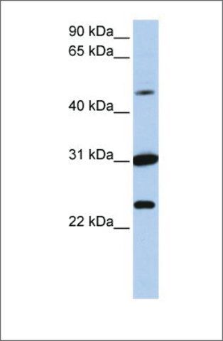 Anti-XK (ab1) antibody produced in rabbit