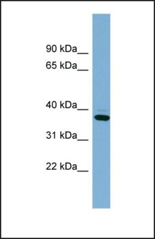 Anti-XAF1 antibody produced in rabbit