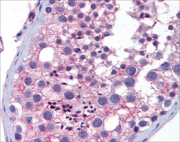 Anti-Wnt10a antibody produced in rabbit