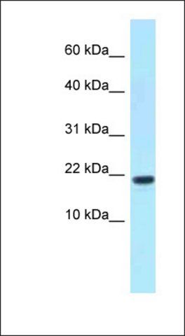 Anti-XAGE1D antibody produced in rabbit