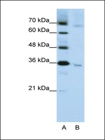 Anti-WNT5B antibody produced in rabbit