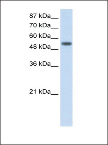 Anti-YARS antibody produced in rabbit