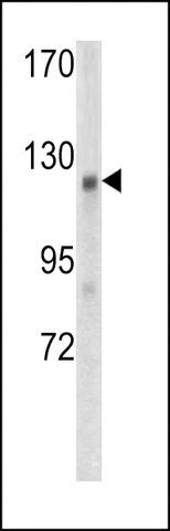 ANTI-WTX (CENTER) antibody produced in rabbit