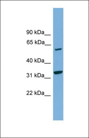 Anti-XPNPEP3, (N-terminal) antibody produced in rabbit