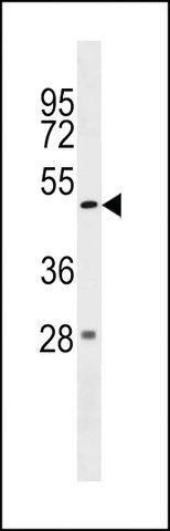 ANTI-ZBTB47 (CENTER) antibody produced in rabbit