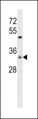 ANTI-ZDHC7(C-TERMINAL) antibody produced in rabbit