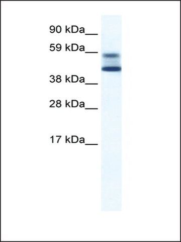 Anti-ZBTB7A (AB2) antibody produced in rabbit