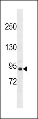 ANTI-ZBTB49(N-TERMINAL) antibody produced in rabbit