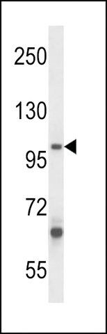 ANTI-ZC3H12B(C-TERMINAL) antibody produced in rabbit