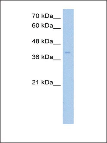 Anti-ZDHHC17 (AB2) antibody produced in rabbit