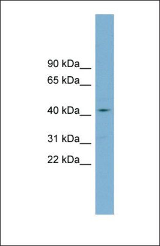 Anti-ZDHHC18 antibody produced in rabbit