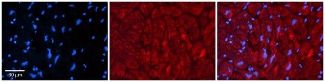 Anti-ZFP36L1 antibody produced in rabbit