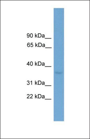 Anti-ZFP444, (C-terminal) antibody produced in rabbit