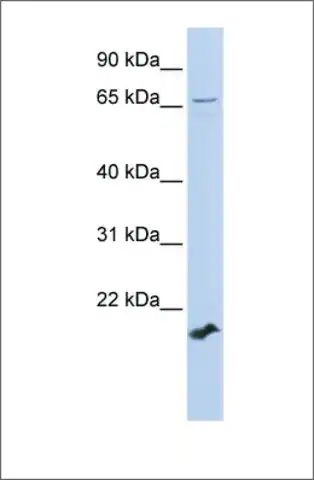 Anti-ZFP37 antibody produced in rabbit