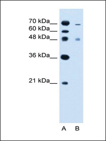 Anti-ZFYVE27 (AB2) antibody produced in rabbit