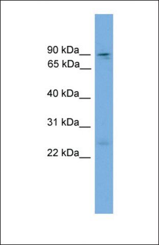 Anti-ZFY1 antibody produced in rabbit