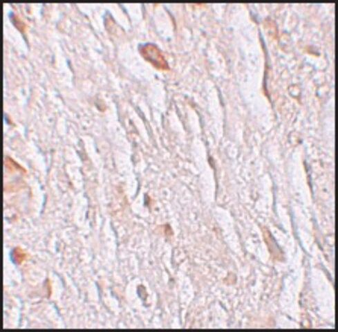 Anti-ZIP7 antibody produced in rabbit