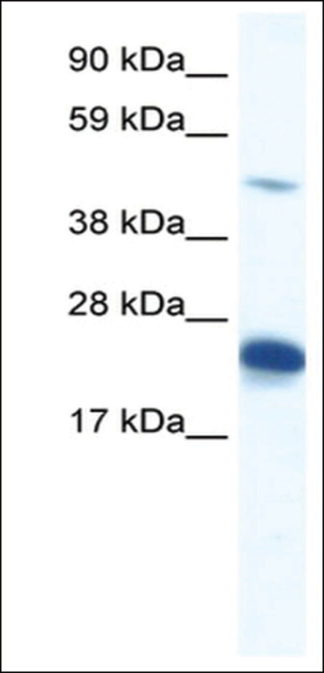 Anti-ZFP57 (AB1) antibody produced in rabbit