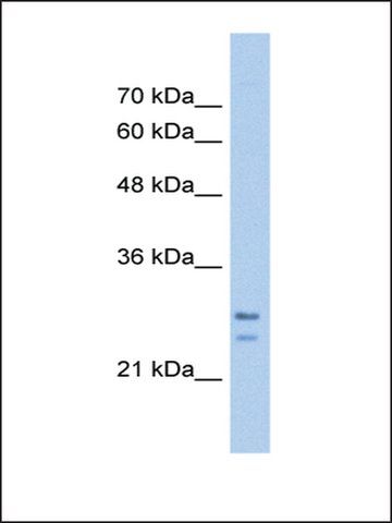 Anti-SRPRB (AB2) antibody produced in rabbit