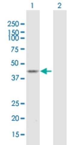 Anti-ST6GALNAC2 antibody produced in mouse