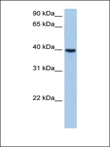 Anti-ST6GALNAC4 antibody produced in rabbit