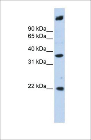 Anti-SSBP3 (ab1) antibody produced in rabbit