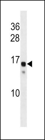 ANTI-SSX11(N-TERMINAL) antibody produced in rabbit