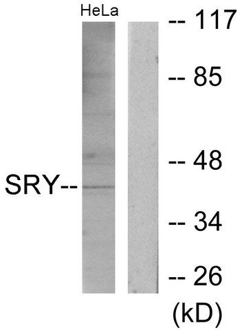 Anti-SRY antibody produced in rabbit