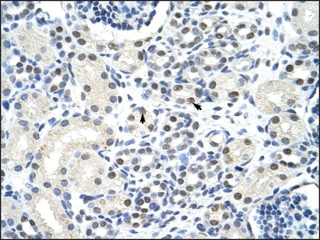 Anti-SSB antibody produced in rabbit