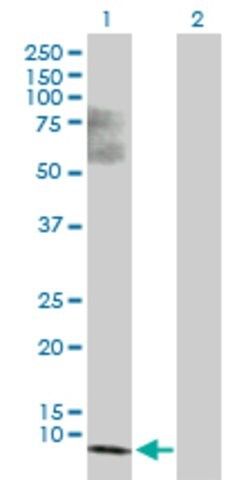 Anti-SS18L2 antibody produced in mouse