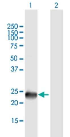 Anti-SSX9 antibody produced in mouse