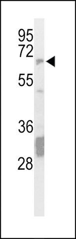 ANTI-STEP / PTPN5(N-TERMINAL) antibody produced in rabbit