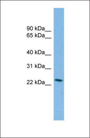 Anti-SSX4B antibody produced in rabbit