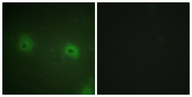 Anti-STAM2 antibody produced in rabbit