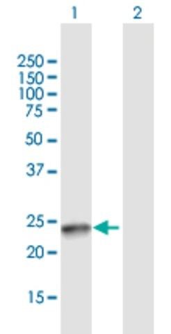 Anti-SSX4B antibody produced in mouse