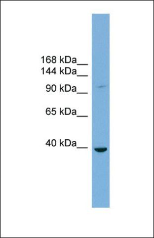 Anti-ST14 antibody produced in rabbit