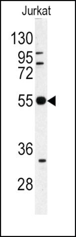 Anti-SUV39H2 (N-term G107) antibody produced in rabbit