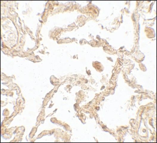 Anti-SUZ12 antibody produced in rabbit