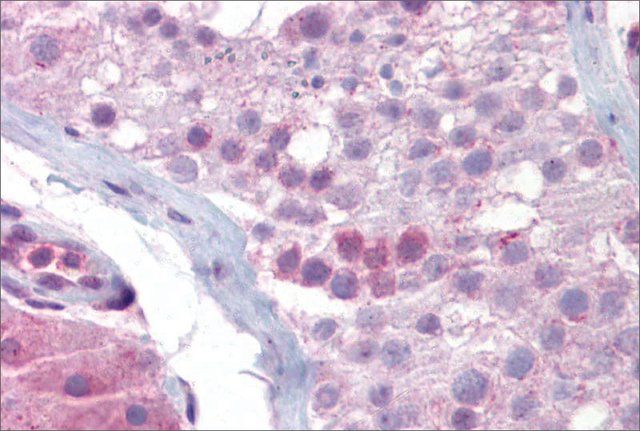 Anti-SYCP3 antibody produced in rabbit