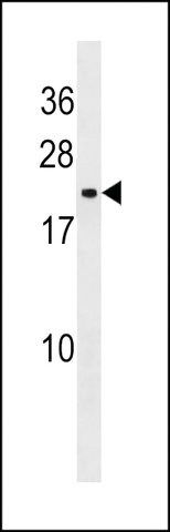 ANTI-STAG3L1 (CENTER) antibody produced in rabbit