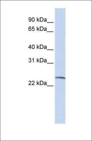 Anti-SSX6 antibody produced in rabbit