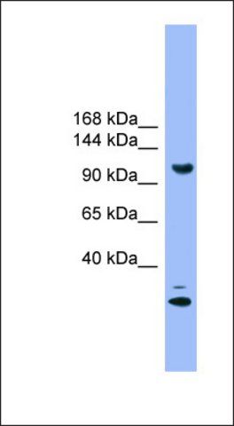 Anti-STARD8 antibody produced in rabbit