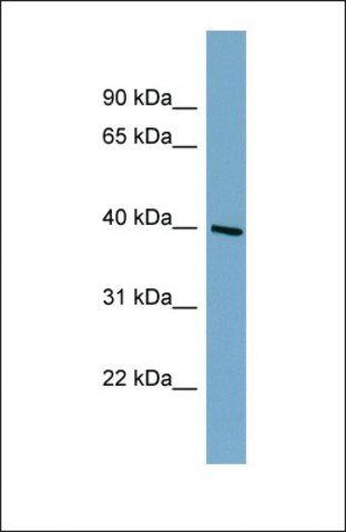 Anti-ST8SIA6 antibody produced in rabbit