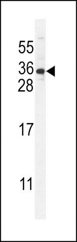 ANTI-STARD6 (C-TERM) antibody produced in rabbit