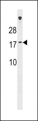 ANTI-SSX7(N-TERMINAL) antibody produced in rabbit